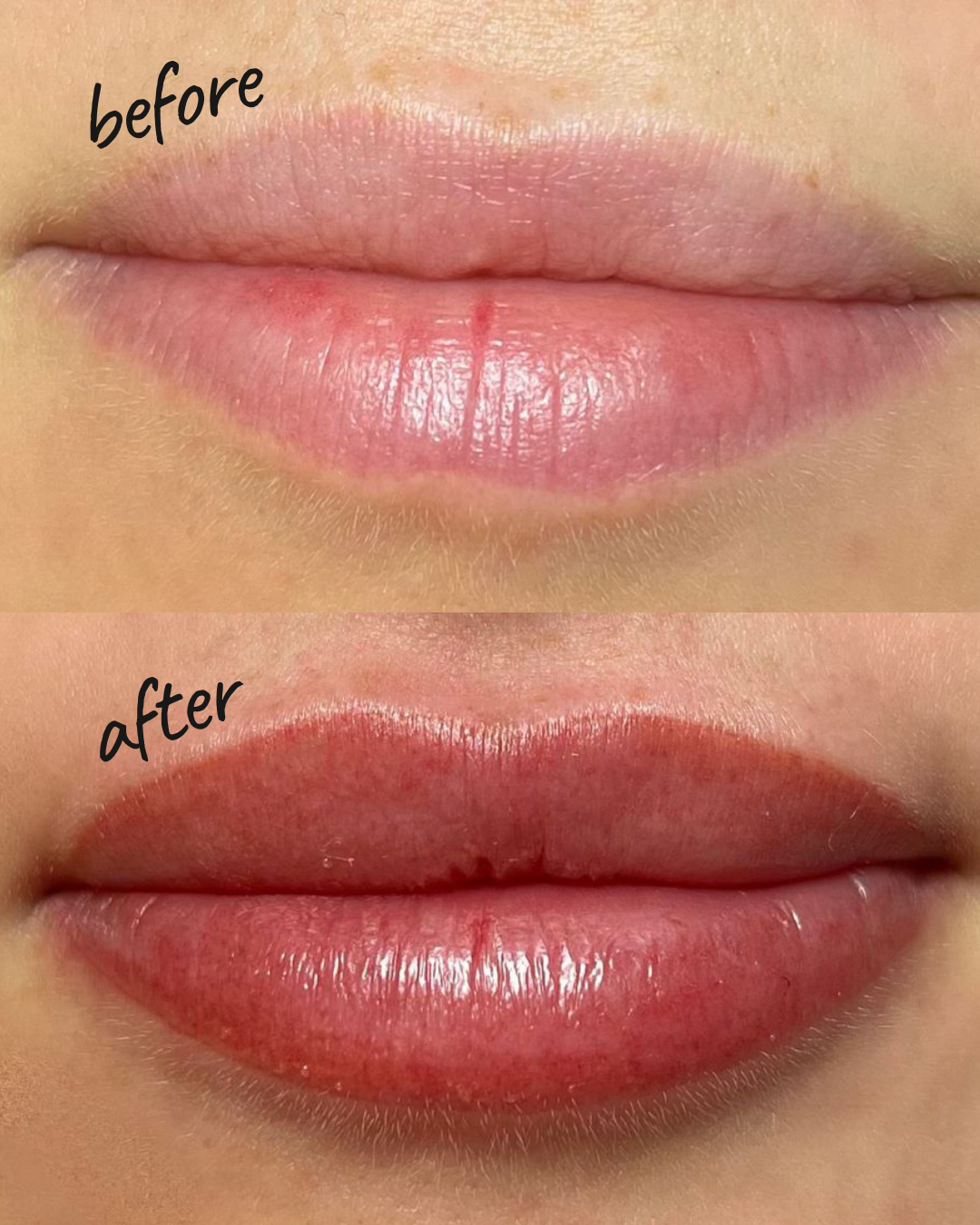 before after skincare NYC